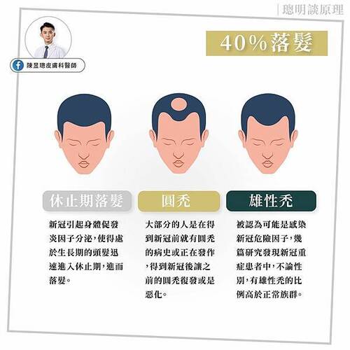 新冠染疫後40%會有脫髮的可能